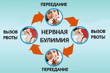 Лечение булимии в Выльгорте